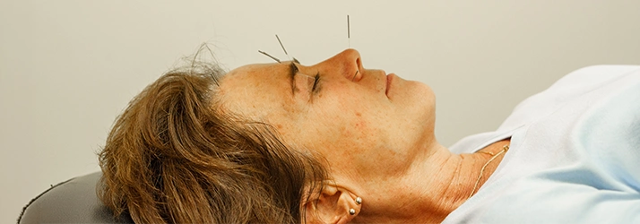 Patient With Acupuncture Needles In Their Face