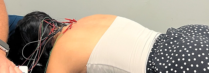 Woman Receiving Acupuncture